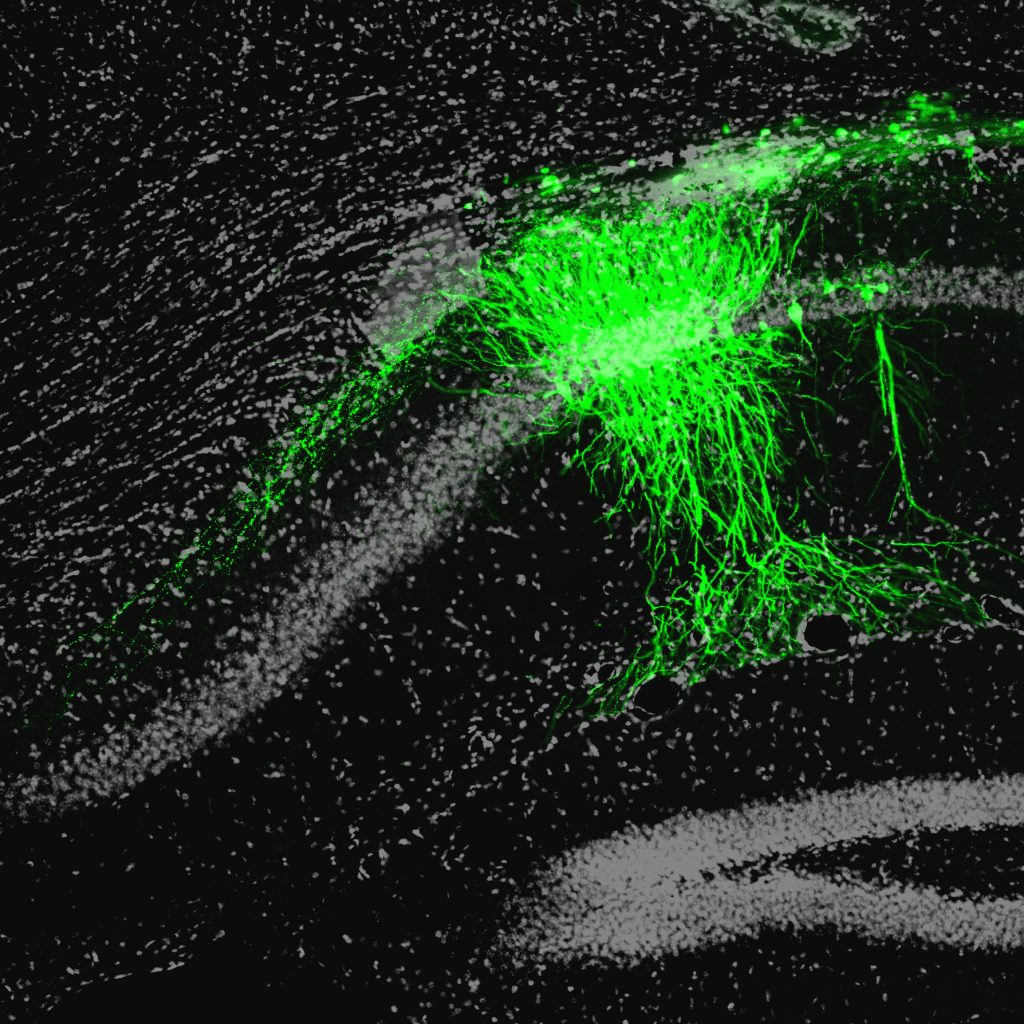 hsv-gfp ca1b